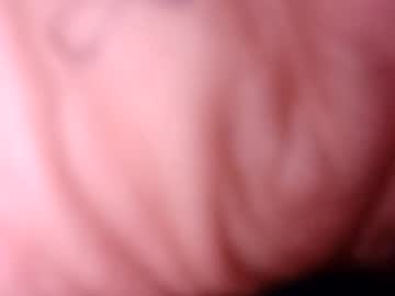 aroum7286