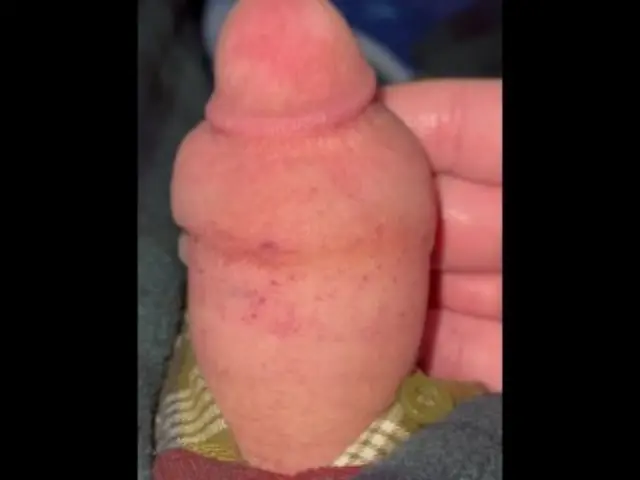 Penis pump fail. 4K 120 FPS #13